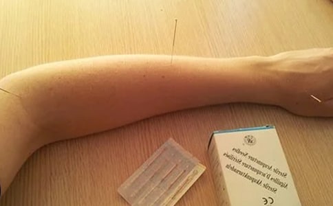 針灸推拿自薦書范文